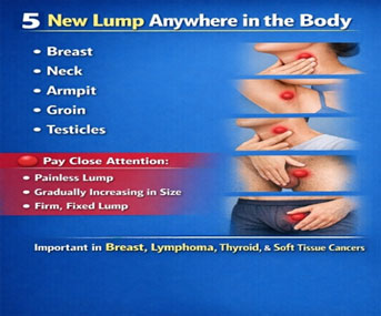 स्तन कर्करोग