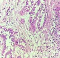 हिस्टोपॅथॉलॉजी आणि सर्जिकल पॅथॉलॉजी म्हणजे काय ?